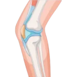 Bone & Joint Care